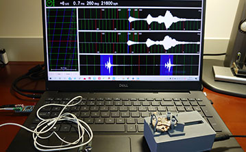 昆仑手表消磁(免费) 昆仑手表消磁(免费)